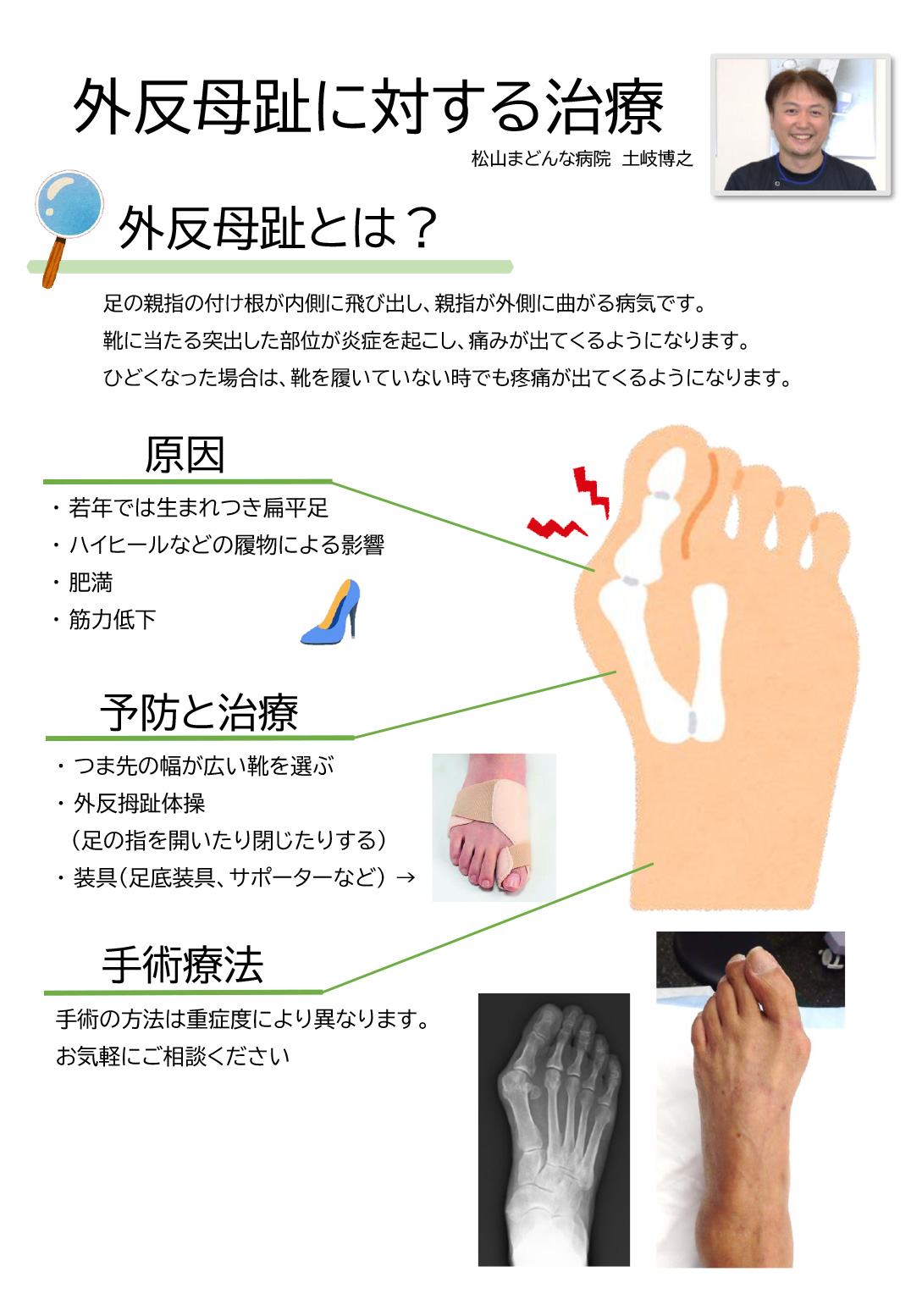 外反母趾に対する治療