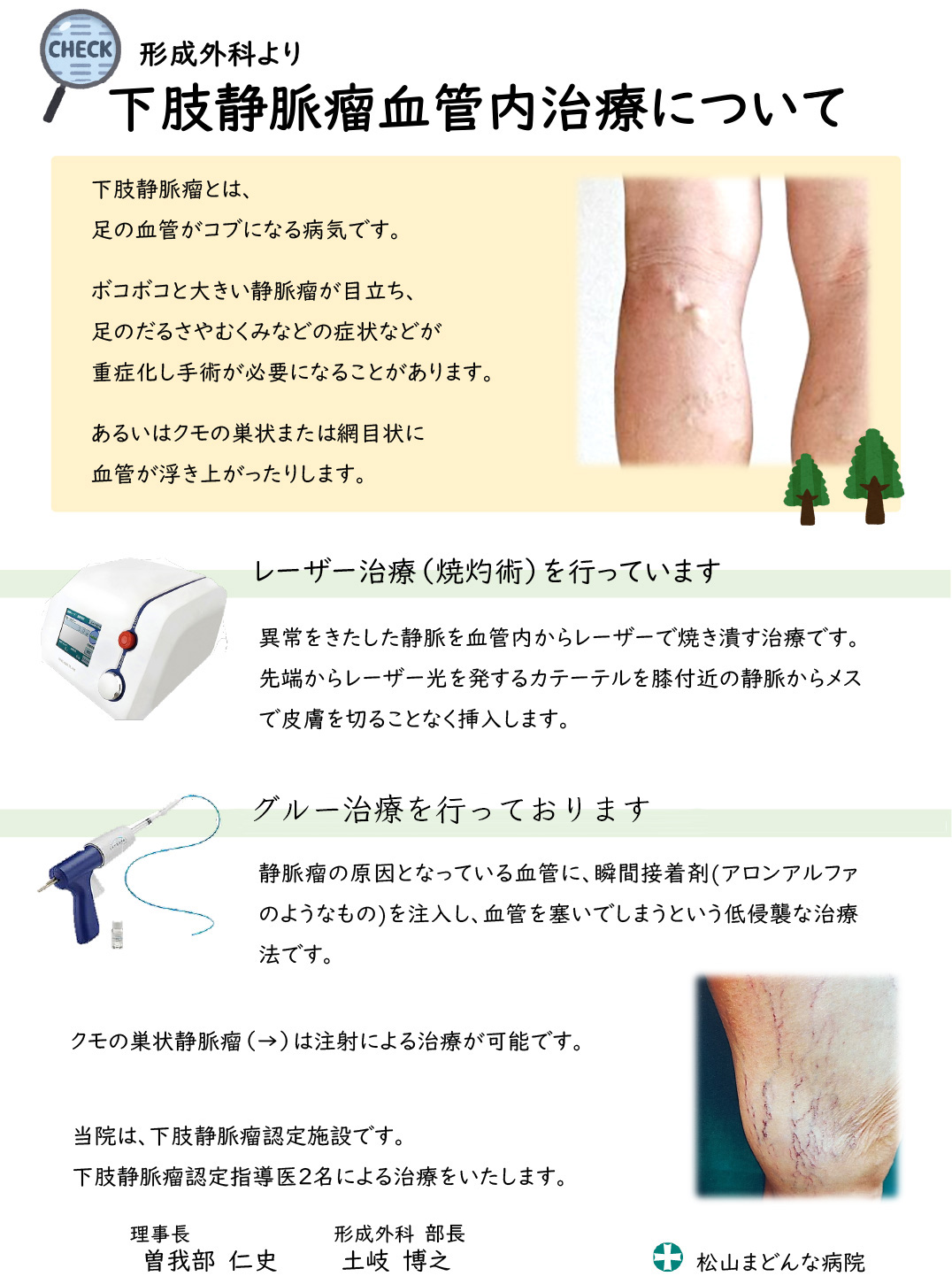 下肢静脈瘤血管内治療
