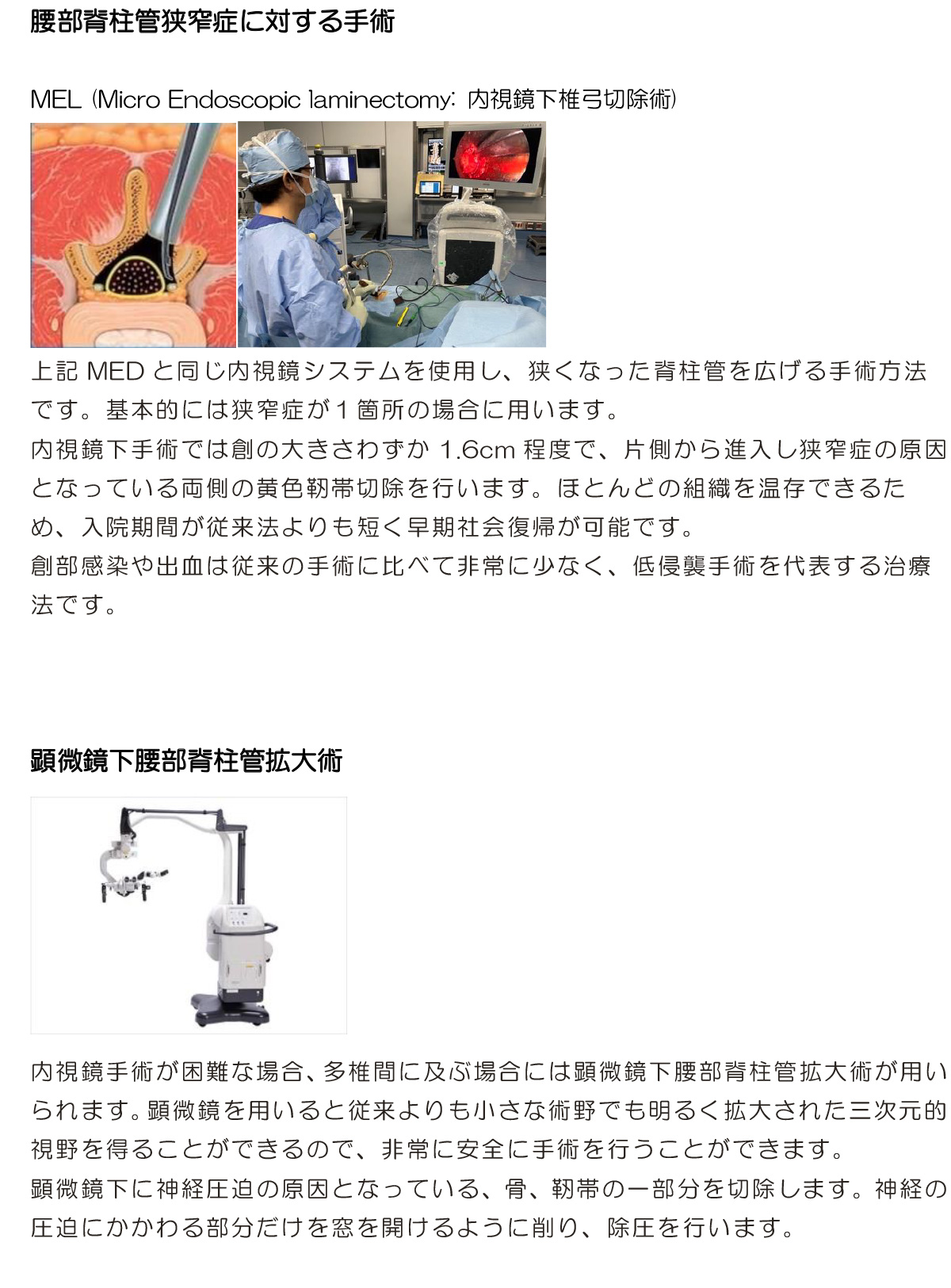 腰部脊柱管狭窄症に対する手術